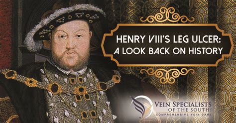 henry the 8th leg sores.